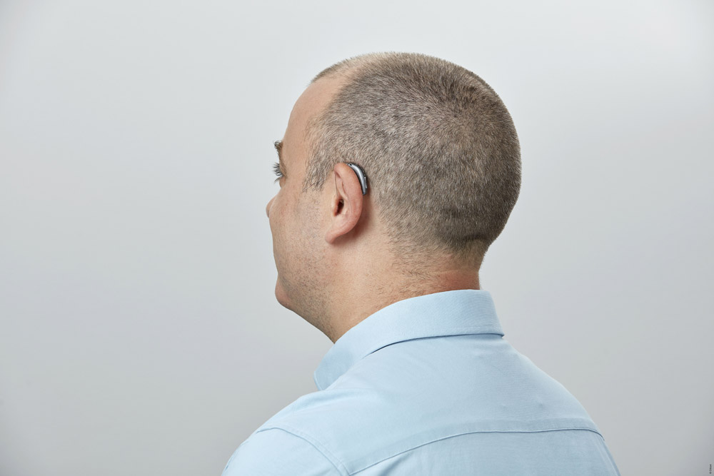 Oticon Zircon BTE - Image 4